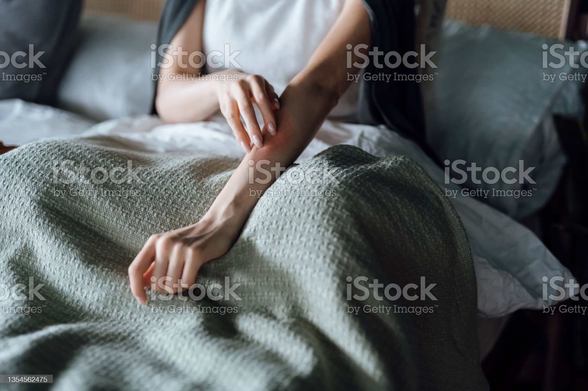 Ihminen jolla on ihottumaa   sdd fkädessä